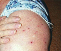 8BB bites 8BB bites